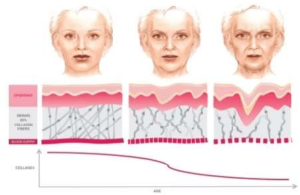 Facial skin deficiancy in collagen