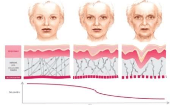 Facial skin deficiancy in collagen